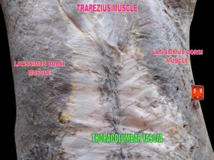 picture of the Thoracolumbar Fascia